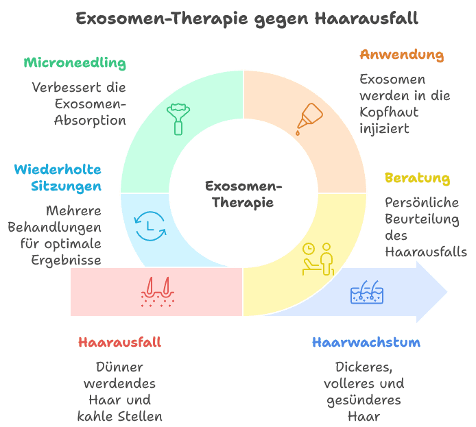 Infografik zur Exosomen-Therapie gegen Haarausfall: Darstellung von Beratung, Anwendung, Microneedling und wiederholten Sitzungen, die von Haarverlust zu stärkerem Haarwachstum führen.